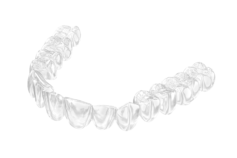 Invisalign® – Clear Braces, Types of Braces